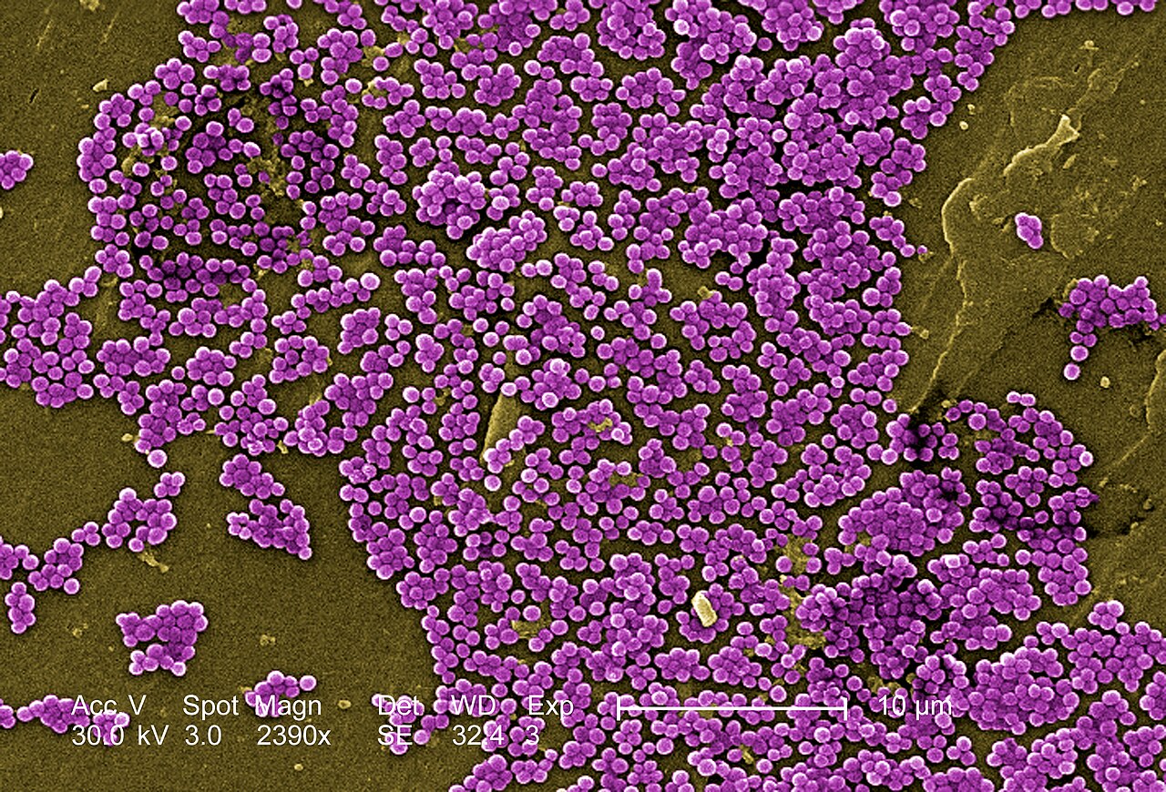 Illustration: MRSA bacteria under an electron microscope. CDC/Jeff Hageman, Janice Haney Carr/Wikimedia Commons (public domain)